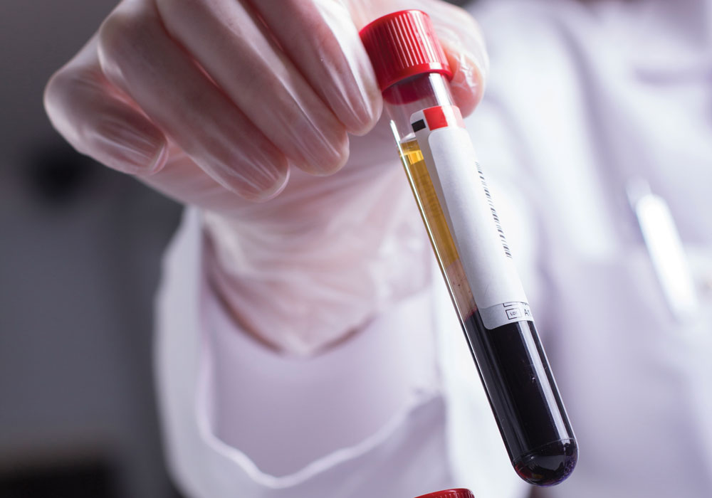 What Is a Liquid Biopsy?